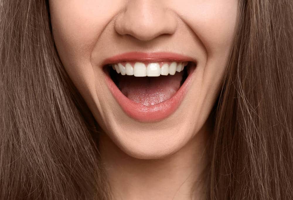Estética dental, la belleza parte de la boca