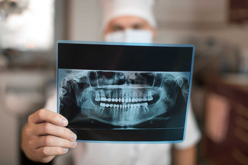 La importancia de las radiografías dentales