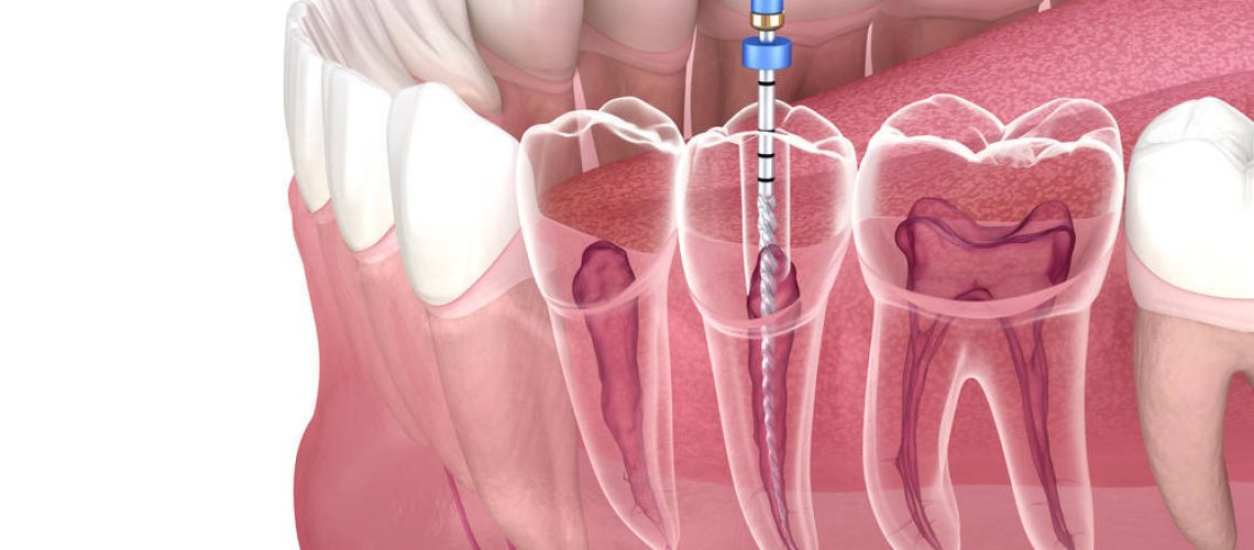 shutterstock_1780338830(FILEminimizer)